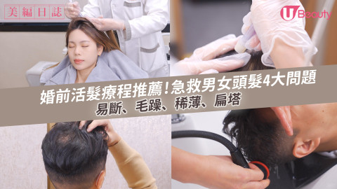 婚前活髮療程推薦！急救男女頭髮4大問題