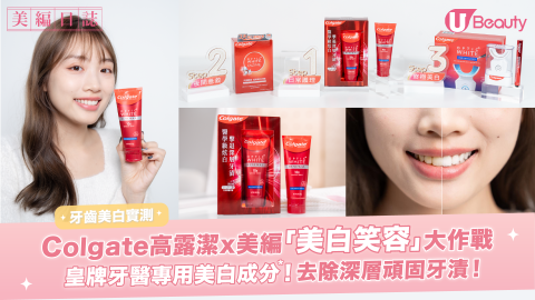 Colgate高露潔x美編「美白笑容」大作戰！皇牌牙醫專用美白成分！去除深層頑固牙漬！