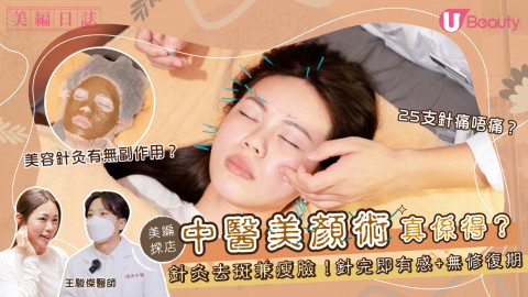 【中醫美顏術】針灸去斑兼瘦臉真係得？針完即有感+無修復期